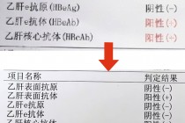 乙肝能治好吗(乙肝能治好吗女性)