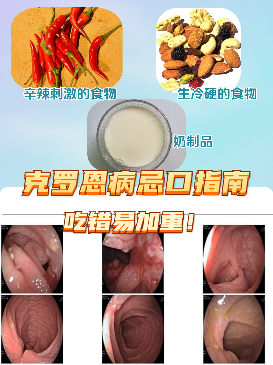 克罗恩病和溃疡性结肠炎的区别(克罗恩病和溃疡性结肠炎的区别?简答题)  第1张